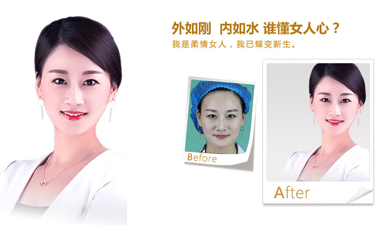 镇江V脸、线雕隆鼻